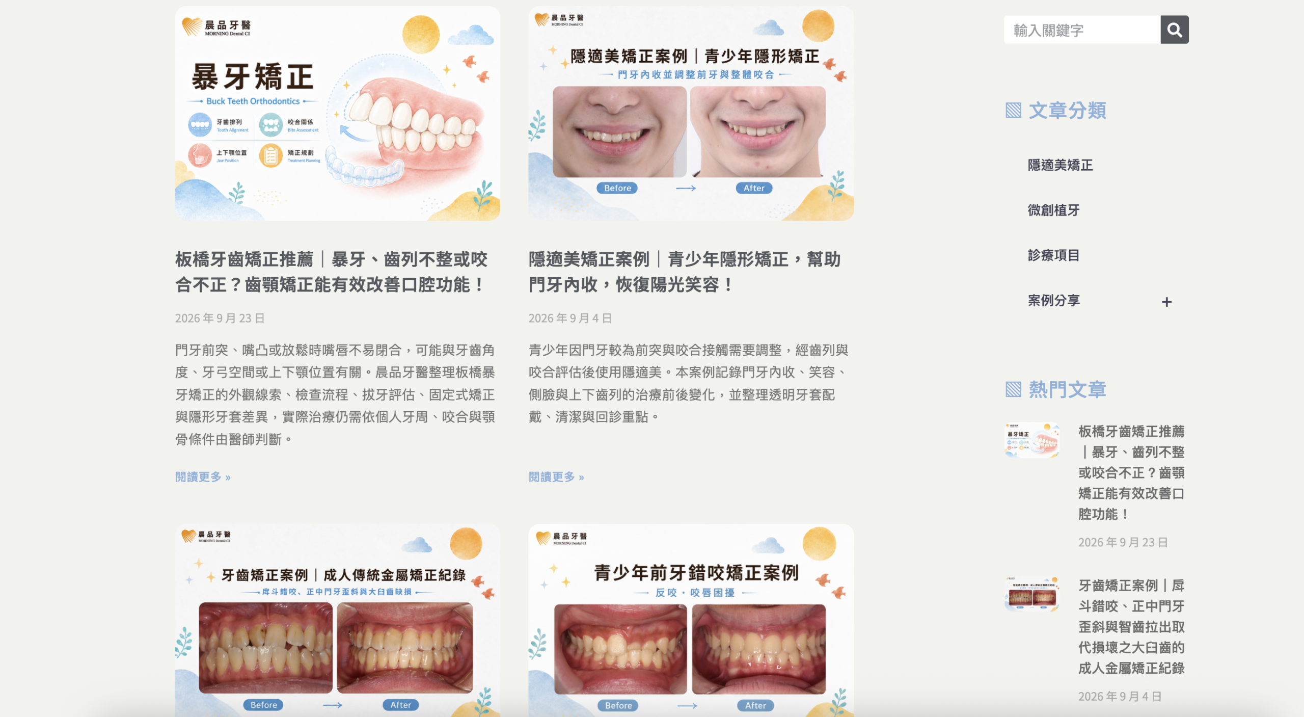 隱適美資訊搭配矯正案例